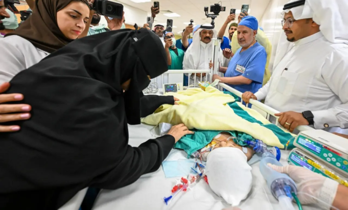 Saudi twins Yara, Lara successfully separated in surgery, marking 65th global milestone for Kingdom’s medical team