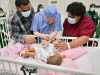 Saudi medical team begins separation surgery of Fijian conjoined twins in Riyadh